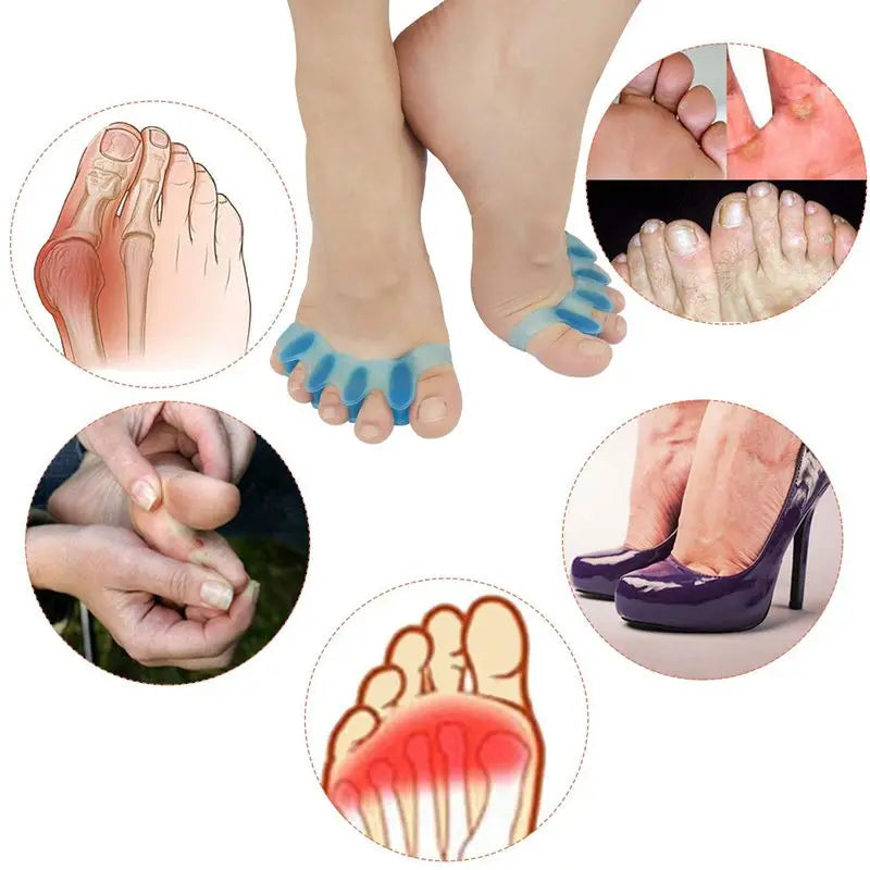 Gel Toe Separators - Bunion Corrector (1 Pair)